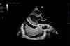 Mindray TE7 Max Point of Care Ultrasound