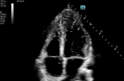 Mindray TE7 Ultrasound System Crystal Series 2.0