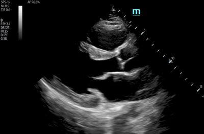 Mindray TE7 Ultrasound System Crystal Series 2.0