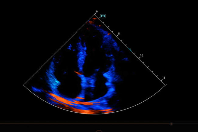 Mindray Consona N9 Ultrasound Machine (72-Month Subscription)
