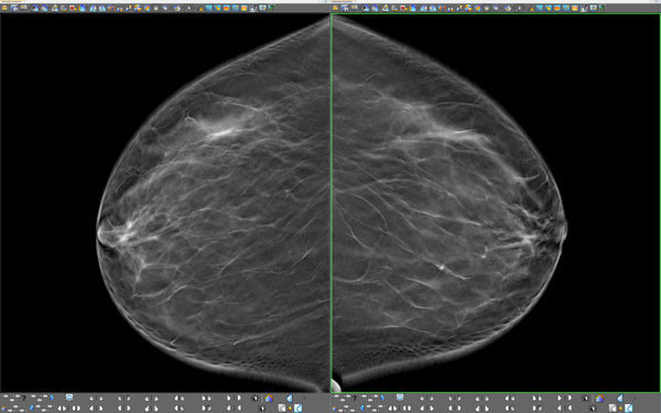 ImageGrid Mini PACS System iMD-2 1.8TB