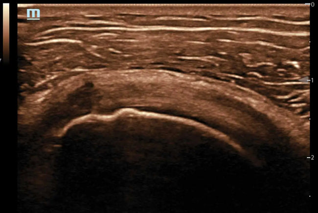Mindray TE5 Ultrasound System