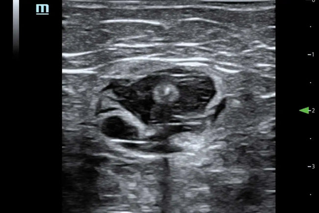 Mindray TE5 Ultrasound System