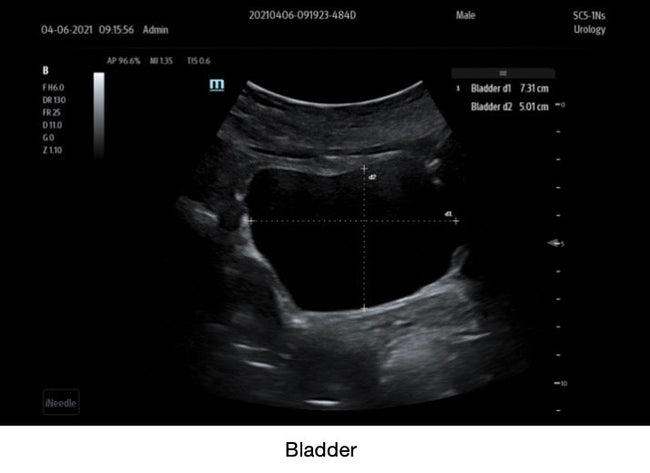 Mindray TE7 Max Point of Care Ultrasound