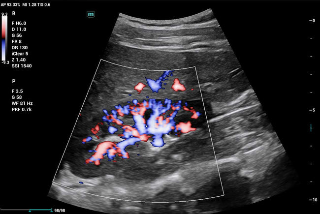 Mindray Consona N9 Ultrasound Machine (72-Month Subscription)