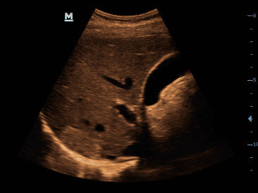 Mindray DP-50 Expert Mobile Ultrasound System (72-Month Subscription)