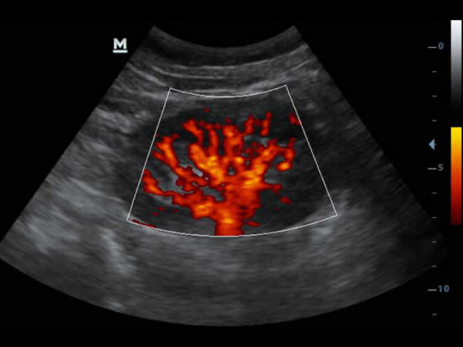Mindray DP-30 Power Ultrasound Imaging System (72-Month Subscription)