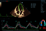 Mindray ZONE Sonography® Technology