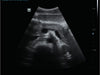 Mindray DP-50 Expert Mobile Ultrasound System (72-Month Subscription)
