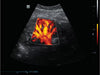 Mindray DP-50 Expert Mobile Ultrasound System (72-Month Subscription)