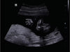 Mindray DP-50 Expert Mobile Ultrasound System (72-Month Subscription)