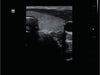 Mindray DP-50 Expert Mobile Ultrasound System (72-Month Subscription)