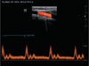 Mindray DP-50 Expert Mobile Ultrasound System (72-Month Subscription)