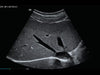 Mindray MX7 Laptop Ultrasound Machine