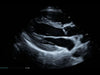 Mindray MX7 Laptop Ultrasound Machine