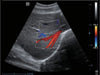 Mindray Z60 Hand-carried Ultrasound System