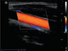 Mindray Z60 Hand-carried Ultrasound System