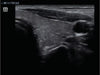 Mindray Z60 Hand-carried Ultrasound System