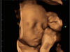 Mindray Z60 Hand-carried Ultrasound System