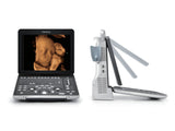 Mindray Z60 Hand-carried Ultrasound System