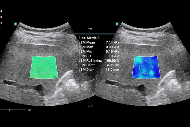 Mindray Consona N9 Ultrasound Machine (72-Month Subscription)