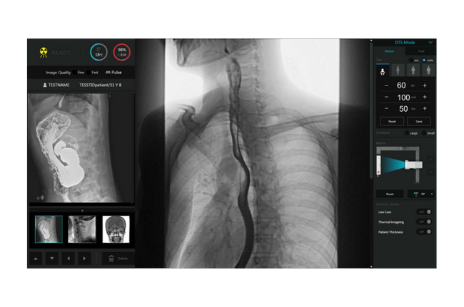 StriXion™ Smart Digital Multi-Modality System