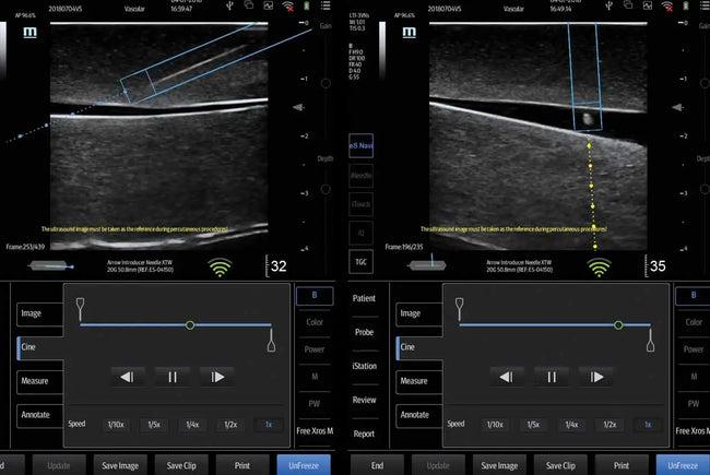 Mindray TE5 Ultrasound System