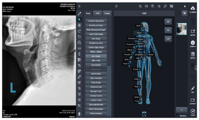 Digital X-ray Panel - 14 x 17 Tethered (72-Month Subscription)