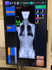 20/20 CFPT 17x48 Full Spine Chiropractic DR Panel