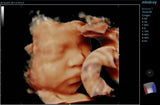 Mindray Resona 7 Platinum Edition Ultrasound System