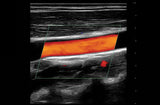 Mindray TE X Portable Ultrasound System