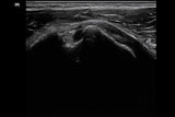 Mindray MX8 Portable Ultrasound Machine