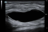 Mindray TE5 Ultrasound System