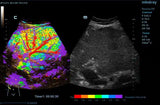 Mindray Resona 7 Platinum Edition Ultrasound System