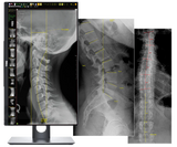 20/20 CFPT Tethered 17x17 Chiropractic Direct Digital Imaging System - DR Panel