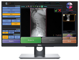 20/20 CFPW Wireless 14x17 CHIROPRACTIC Direct Digital Imaging System - DR Panel