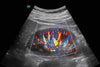 Mindray Consona N6 Diagnostic Ultrasound System (72-Month Subscription)