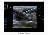 Mindray TE7 Ultrasound System Crystal Series 2.0