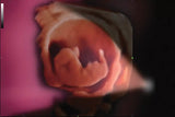 Mindray Imagyn I9 - Ultrasound Imaging