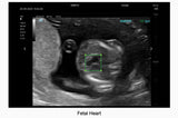 Mindray TE7 Max Point of Care Ultrasound
