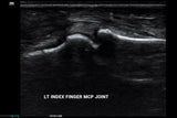 Mindray MX8 Portable Ultrasound Machine