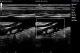 Mindray Resona 7 Platinum Edition Ultrasound System