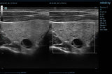 Mindray ZONE Sonography® Technology