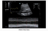 Mindray TE7 Max Point of Care Ultrasound