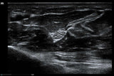 Mindray MX8 Portable Ultrasound Machine