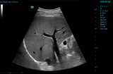 Mindray Resona 7 Platinum Edition Ultrasound System