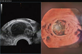 Mindray Imagyn I9 - Ultrasound Imaging