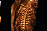 Mindray Imagyn I9 - Ultrasound Imaging
