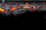 Mindray TE5 Ultrasound System