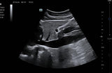 Mindray TE7 Max T Ultrasound